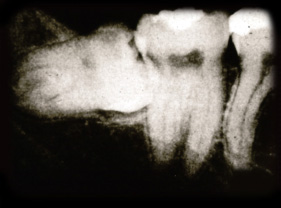 Impaction 4.8 PA UM.jpg